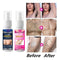 Semi-permanent Hair Removal Spray